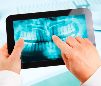 Digital X-Rays, Surrey Dentist